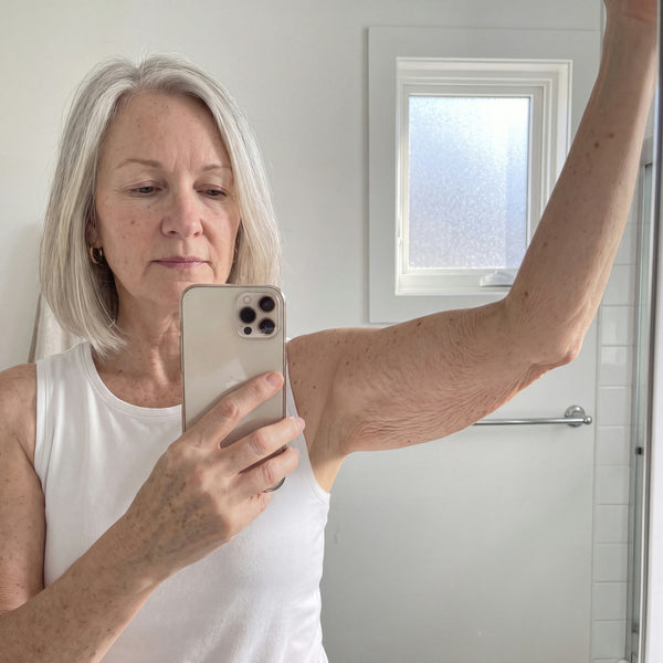 Day 1 arm photo