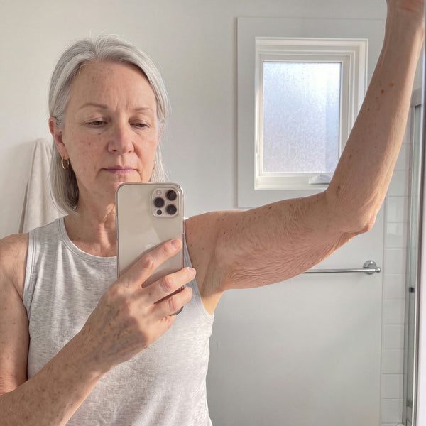 Week 1 arm photo