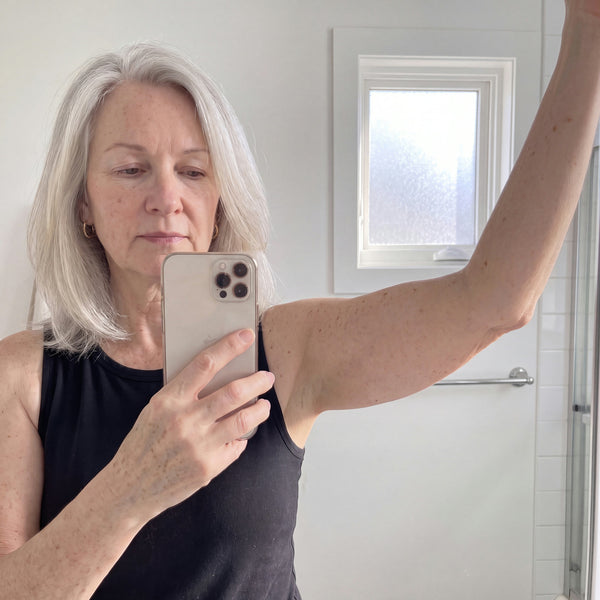 Week 4 arm photo