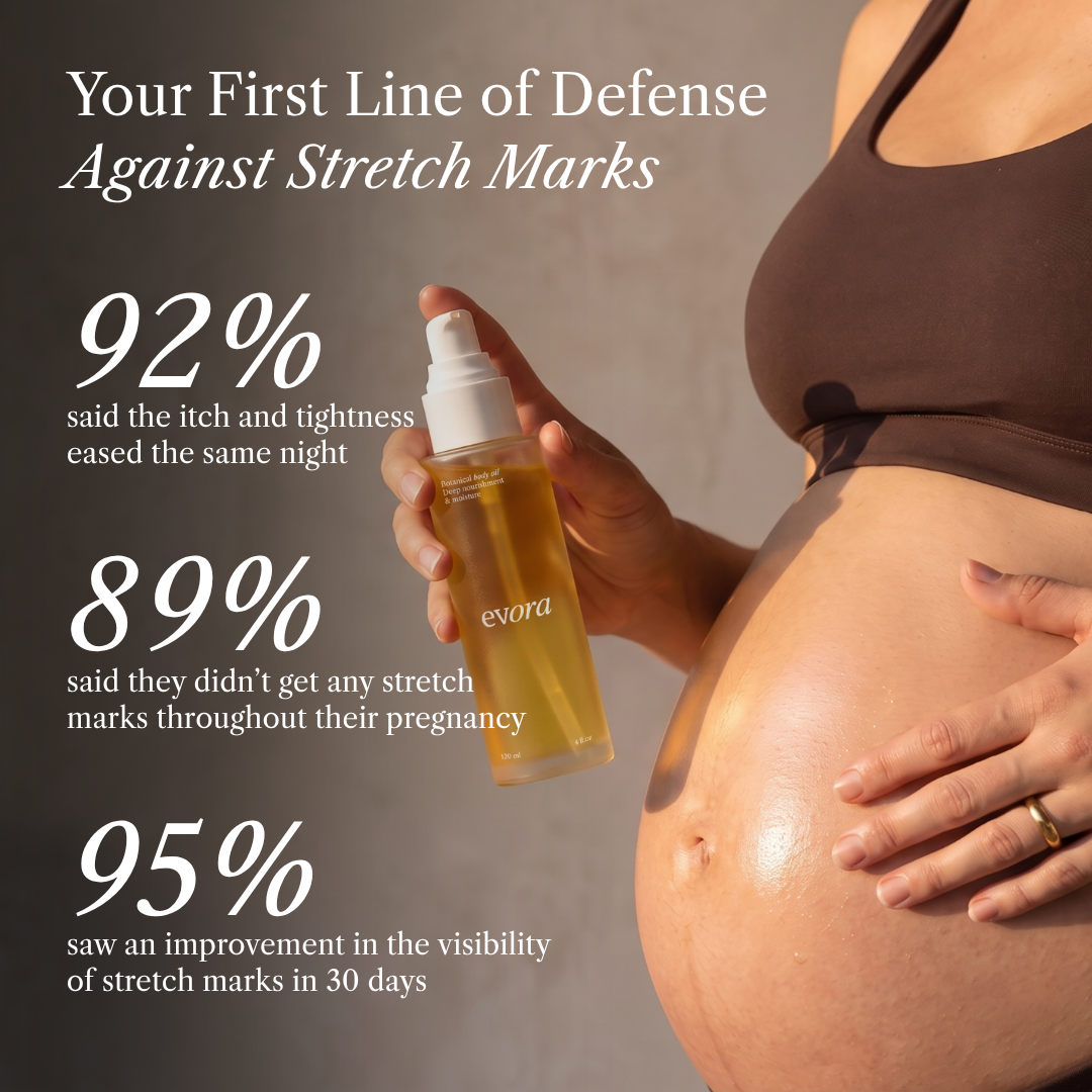 Botanical Belly Oil™ - Stretch Marks