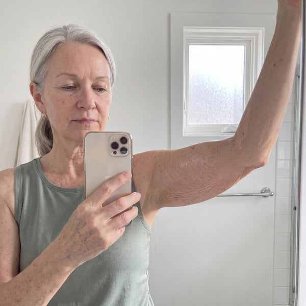 Week 2 arm photo