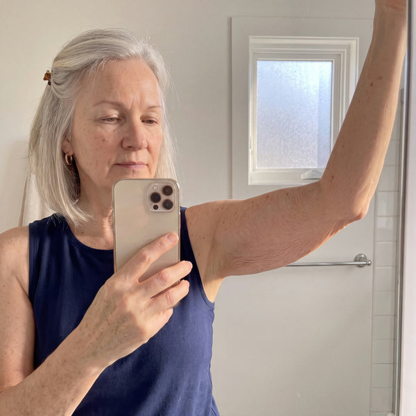 Week 3 arm photo